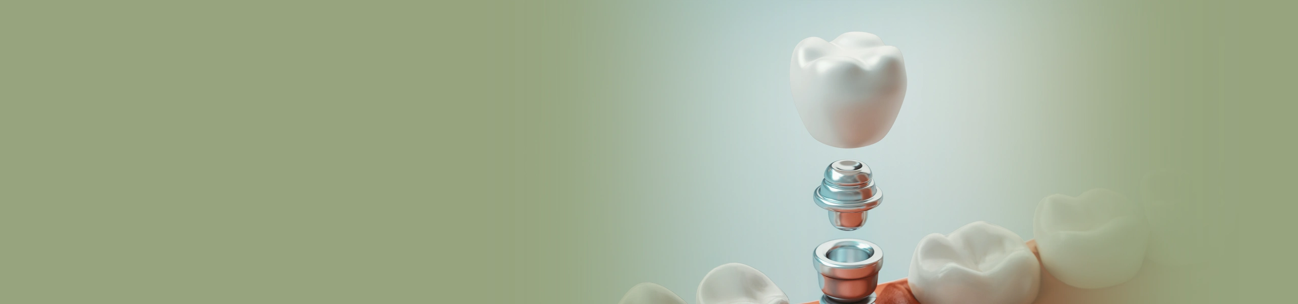 Banner da página Implantodontia